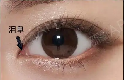 好看的内眼角一定要有正常的泪阜形态,符合个人风格,才能兼具形态美和