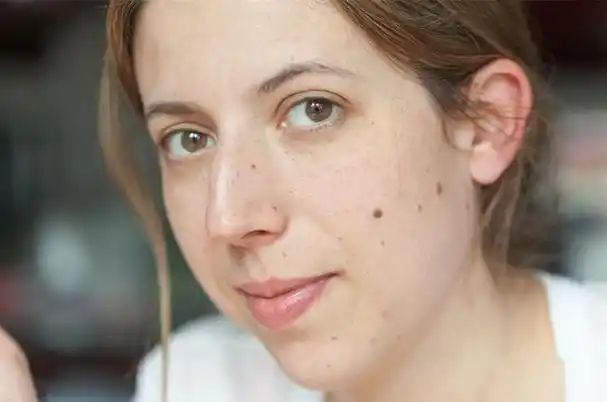 你脸上有痣吗?痣的位置不同,命运大有不同!