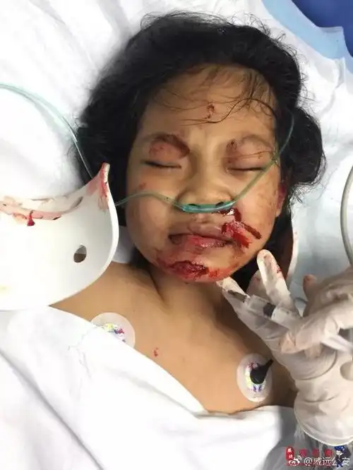 孩子家长已找到!新中医院门口小女孩遭遇车祸最新消息发布.