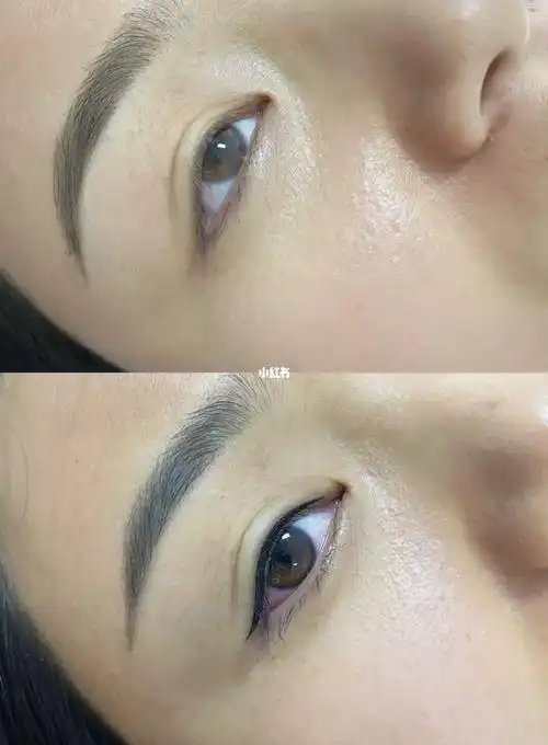 美瞳线前后对比