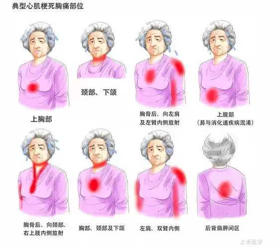 中国首部心梗防治微电影转发1次可能挽救1条生命