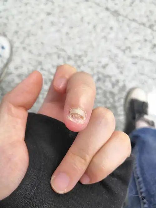 大概本组最严重的空甲