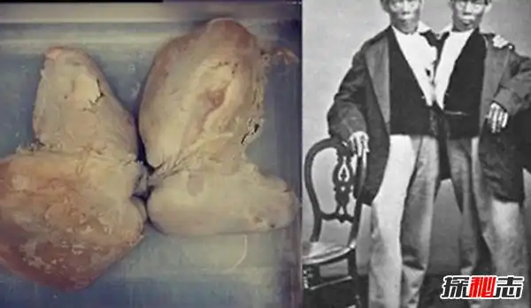 美国穆特博物馆肥皂女尸重口味分分钟想吐腐烂女尸成肥皂