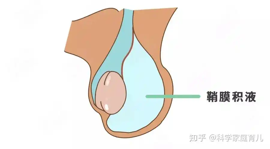 蛋蛋一高一低,一大一小正常吗?男娃5大私处问题,错不起!