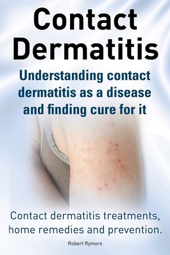 contact dermatitis treatments, home remedies and prevention.