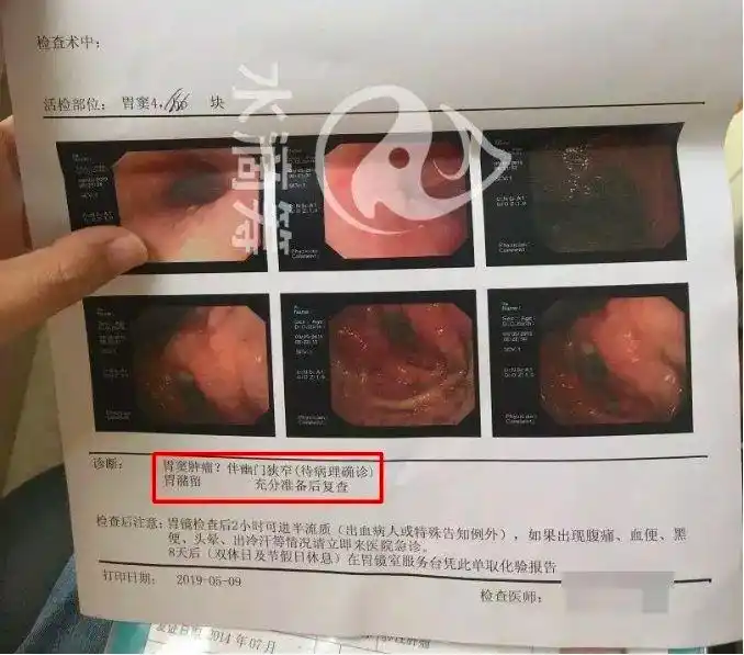 在水滴筹发起20万元筹款,模仿自己父亲的口吻,讲述了自己患胃癌的经历