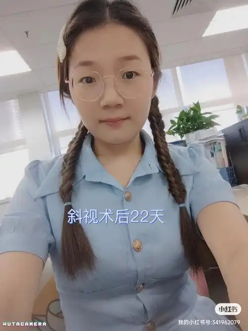 斜视术后22天
