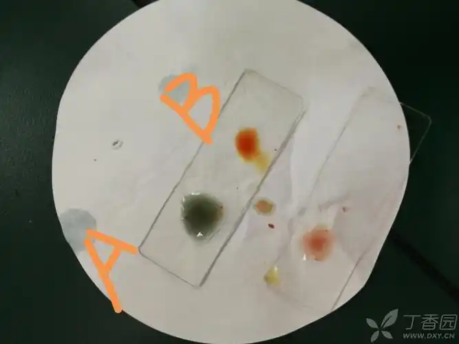 为什么做免疫实验测血型时