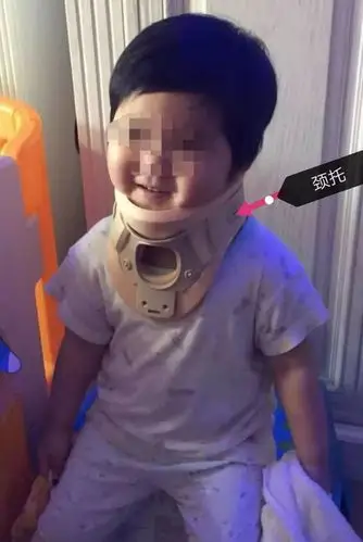 就送到医院儿科的急诊,看了以后,大夫就给她戴上了一个脖子上的"箍儿"