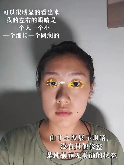 左右眼不对称的姐妹看过来!