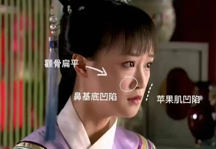 纹很深,侧面看"—马平川",面部层次感弱,这就是典型的——面中凹陷!