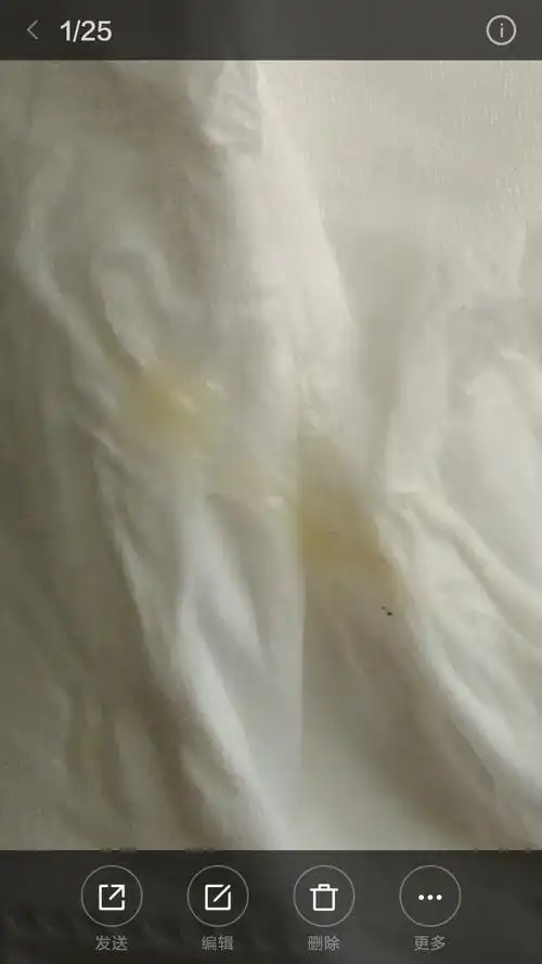 白带发黄,这个要去治吗?(有图慎入)