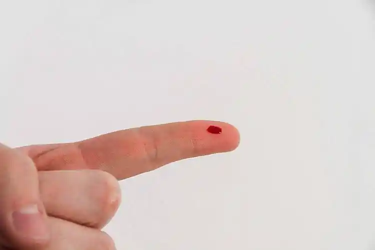 流血的手指图片