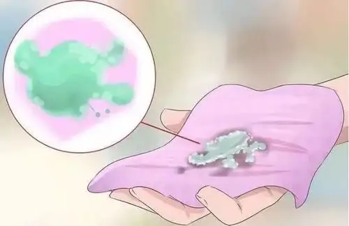 女人注意这6种阴道分泌物有3种不正常一旦出现尽快调理身体