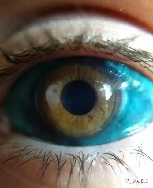 人皮日志第398篇世界上最恐怖的眼球纹身