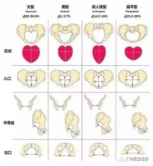 男型:这种骨盆往往容易造成难产,我国女性仅占1%～4%左右,是最少见的