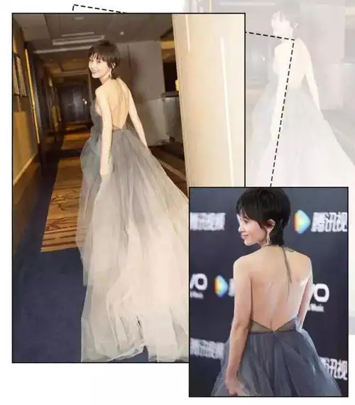 看起来像长了双小翅膀背上的两片肩胛骨严重外翻体重却只有38公斤!