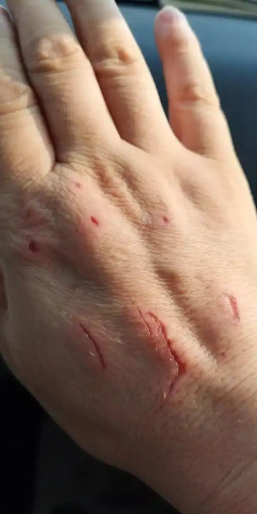 峪口内强收游客停车费,阻挠抓伤执法民警!西安一农妇被依法刑拘.