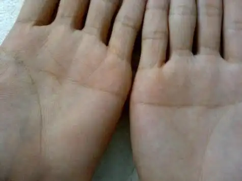 男女双手断掌的生命密码被揭开