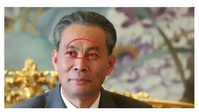 眉间有竖纹好吗眉间两道竖纹好不好