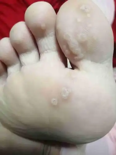 对象脚上长的是什么呀,又像猴子可也不可能那么多啊,有谁知道的吗