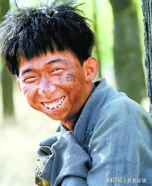 脸部也开始变形,换牙后长出突兀的龅牙,整个人给人一种贼眉鼠眼的感觉