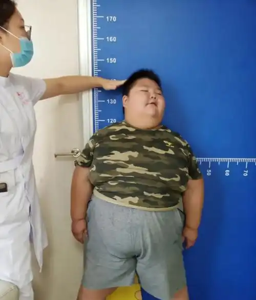 儿童"体重指数标准"出炉,肥胖影响长高,成年更易不孕不育__财经头条