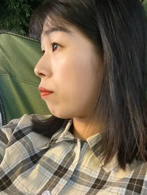 戴了牙套之后才发现脸型改变了很多!以前的侧脸惨不忍睹!