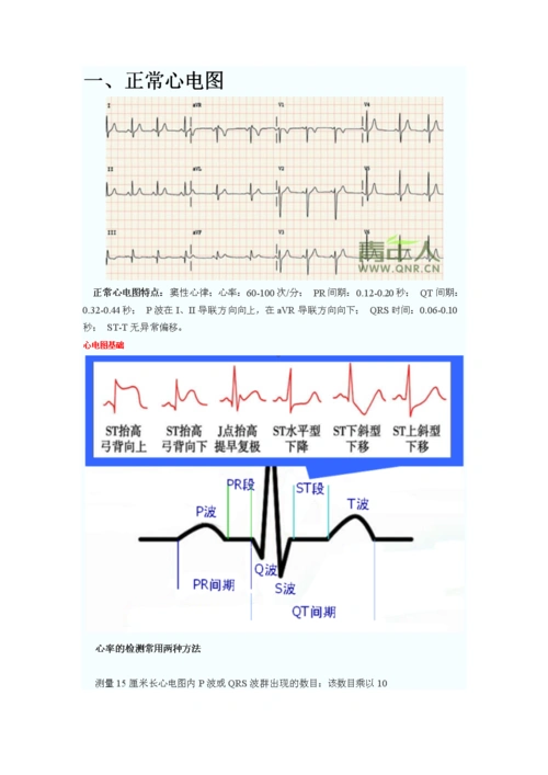 心电图知识总汇.docx