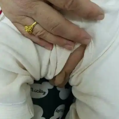 四个月宝宝小鸡头歪