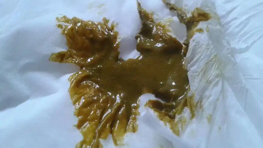 在线等,这种便便是什么情况正常吗?