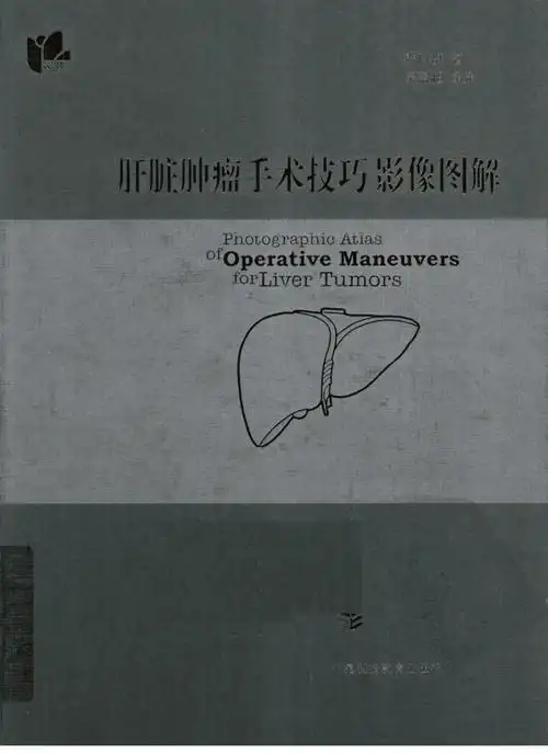 《肝脏肿瘤手术技巧影像图解》严以群著.pdf 358页
