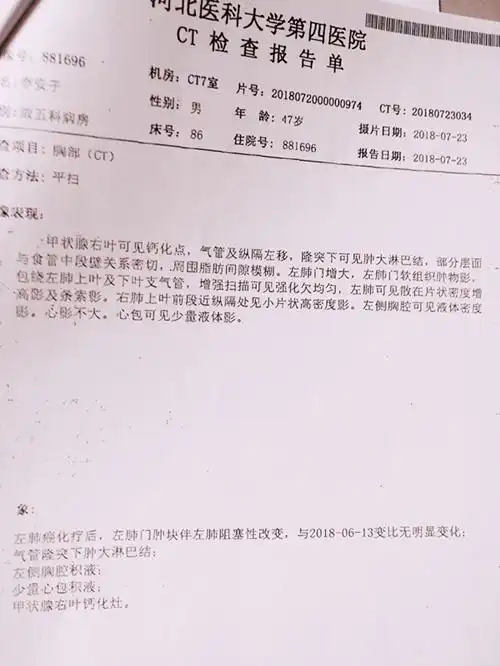 李安子患肺癌求助