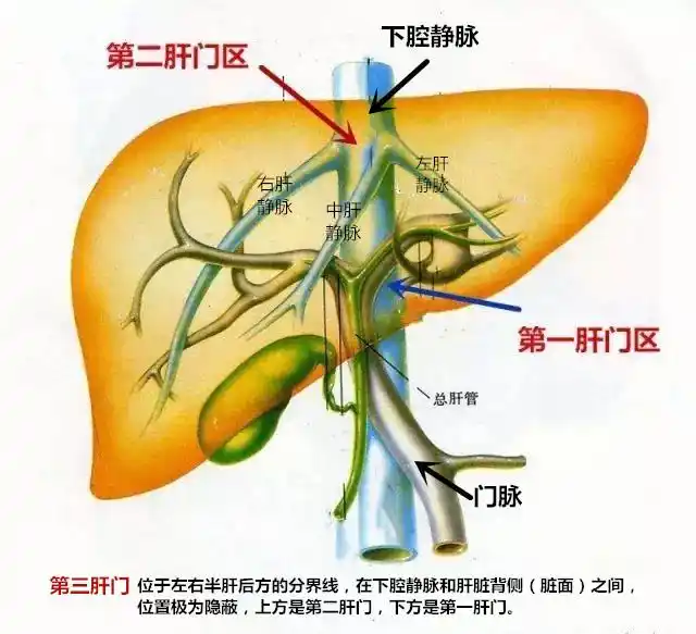 肿瘤藏身肝脏隐秘角落挺进大血管逼近心脏怎么救