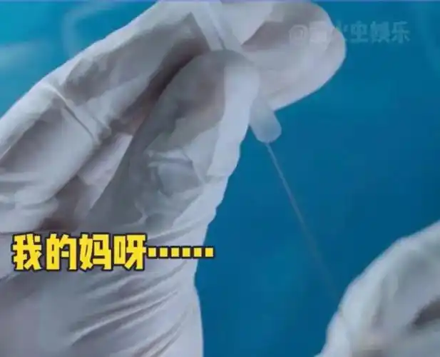 看着就很痛,后面还不知道会面临着什么疾病所以女孩子千万不要为了钱