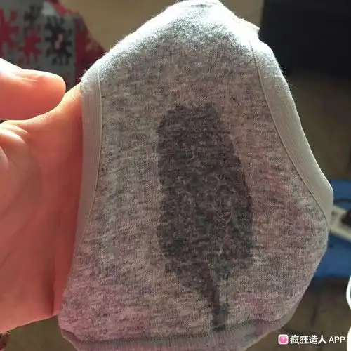 积水是这样水样白带,干了是黄色粉末吗?(有图)