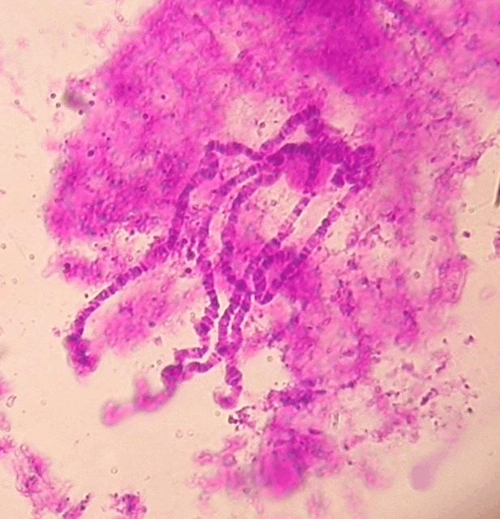 果蝇唾腺染色体图片