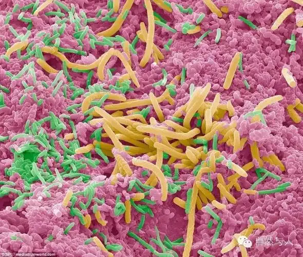 刷牙很重要!看口腔细菌在显微镜下的模样吧