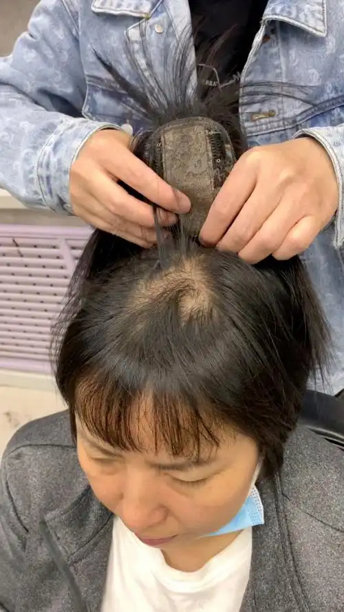女士头顶增加发量