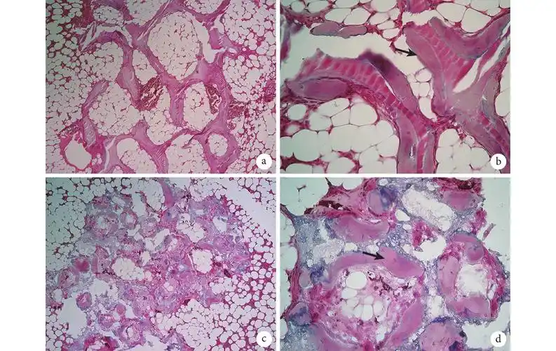 实验组材料周围组织排列正常(×100);b.