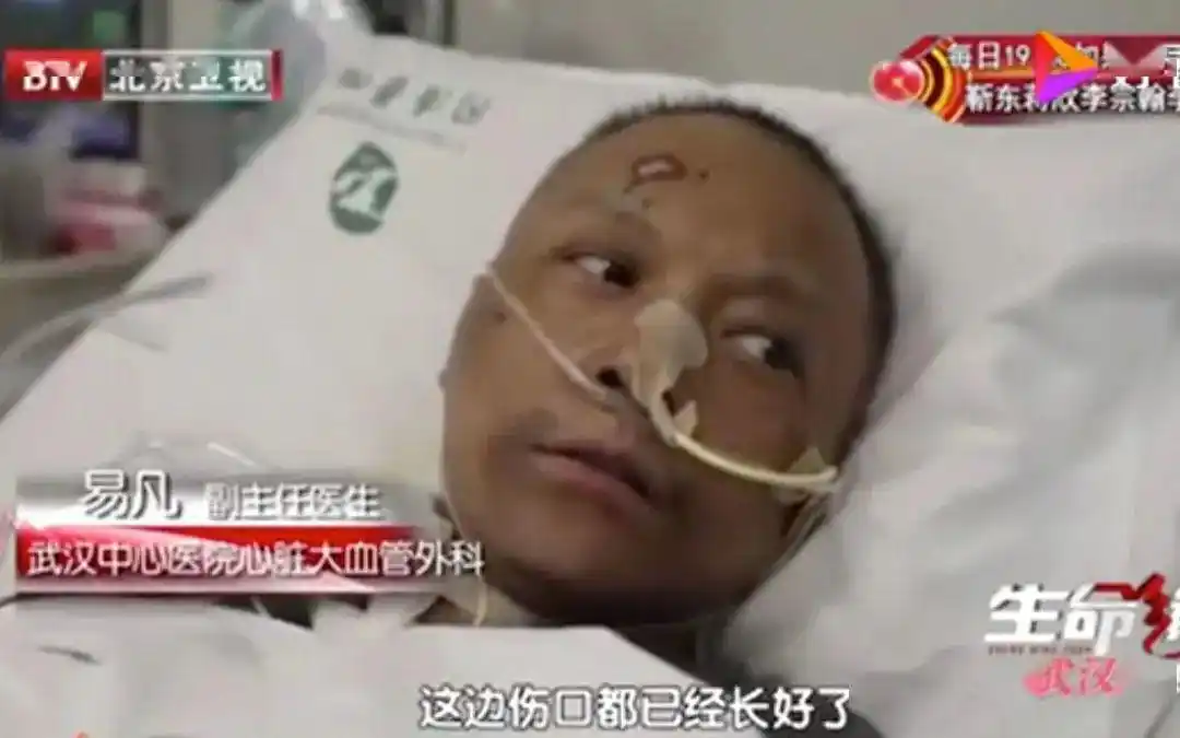 武汉中心医院两医生患新冠后皮肤变黑,系药物致色素沉着