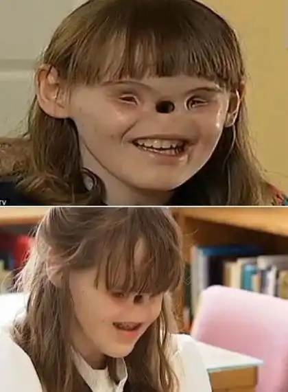 盘点人类史上七大最离奇的怪胎绝对惊爆眼球