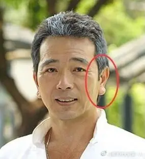 耳朵##耳垂大真的有福气吗