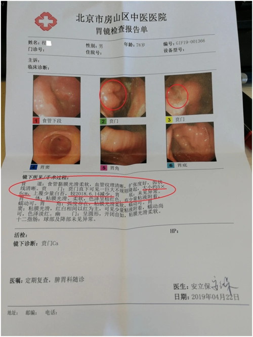 胃癌单纯中医药治疗. - 好大夫在线