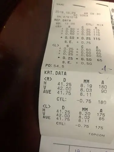 4岁宝宝的视力检查,正常吗?