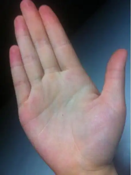 右手掌有痣的女(右手掌有痣的女人旺夫吗)