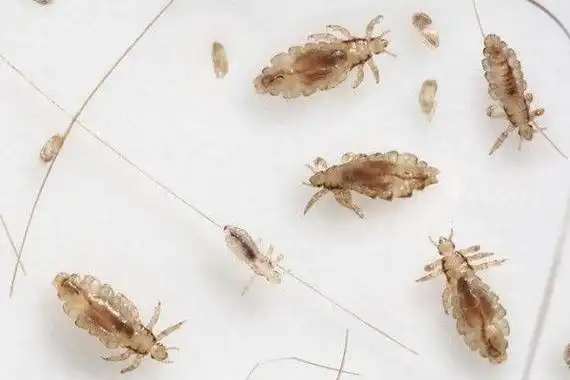 虱子和跳蚤有什么区别 - 即时百科