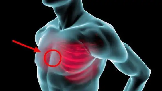 喉咙胀痛,口舌烧灼,原是胸内长了个"胸腺瘤"