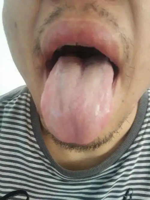 一定不要熬夜这种舌苔的人!