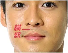 人中有横纹代表什么?